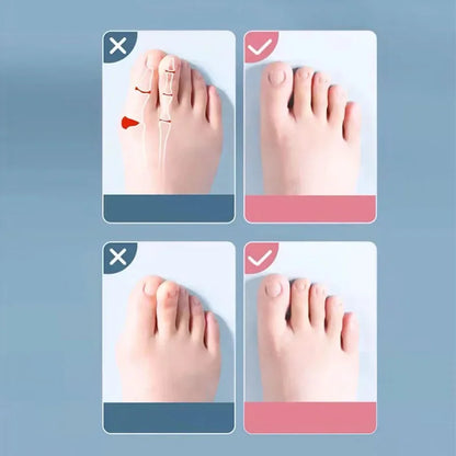 Soft Silicone Toe Spacer & Foot Corrector