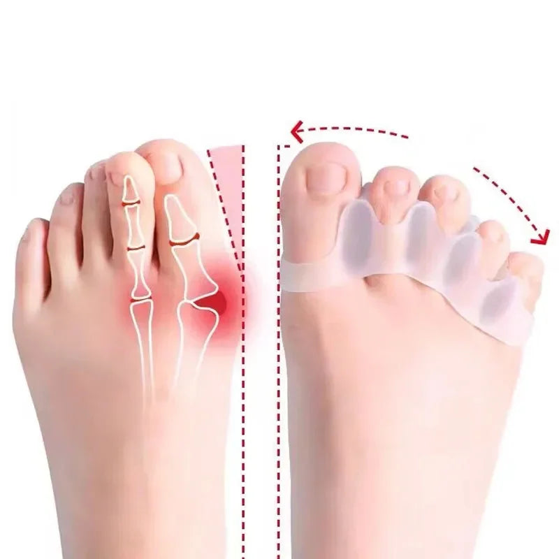 Soft Silicone Toe Spacer & Foot Corrector