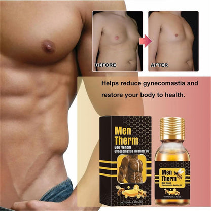 Men Therm Bee Venom Gynecomastia Heating Oil