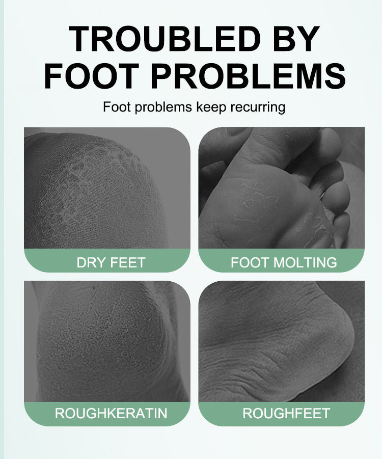 Foot Exfoliation Socks