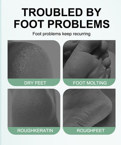 Foot Exfoliation Socks