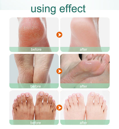 Foot Exfoliation Socks