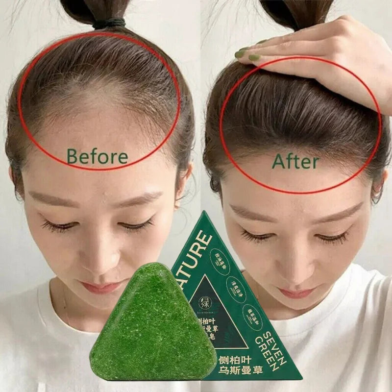 Natural Hair Growth Shampoo Bar