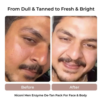 Men's Enzyme De-Tan Face Pack