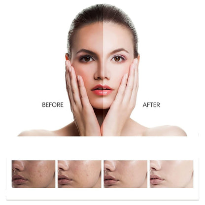 Whitening Facial Cleanser for Freckle Removal & Radiant