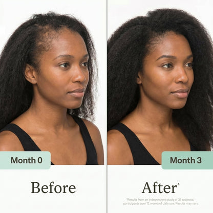 Hair Activator Oil